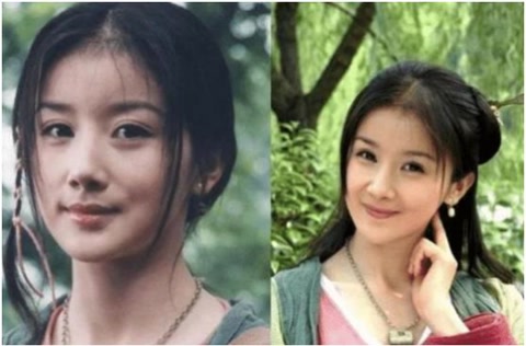 被整容毀了的7位明星，雖各有各的苦衷，卻都美麗盡失、事業滑坡