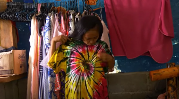 16歲菲律賓少女迅速衰老成60歲老人的臉,尋遍醫生後找出心酸病因 16歲菲律賓少女迅速衰老成60歲老人的臉,尋遍醫生後找出心酸病因