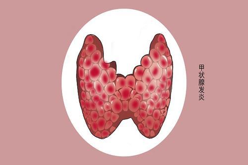 40多歲女性,頭頂多白髮,說明老了?白髮能不能轉黑? 40多歲女性,頭頂多白髮,說明老了?白髮能不能轉黑?