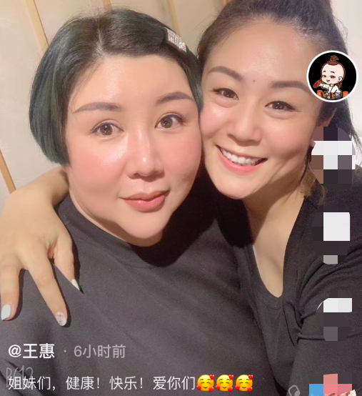 郭德綱妻子現身聚會，瘦出瓜子臉尖下巴明顯，戴鑽石手鐲難掩富貴