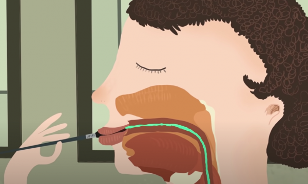 牙齒爛光,臉長巨瘤,骨頭還會發光,被美國資本家逼向絕路的女工 牙齒爛光,臉長巨瘤,骨頭還會發光,被美國資本家逼向絕路的女工