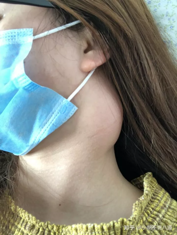 2個月拖成晚期，我錯過了這些黃金癌症警示