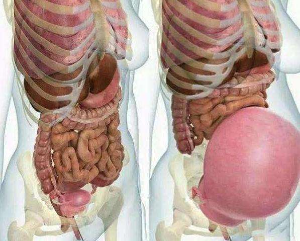 孕婦肚子脹氣不消化，這幾個方法能快速排氣促消化，胎寶發育好