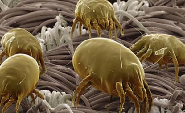 擠壓抓撓後，鼻子上擠出來白色條狀，是什麼東西？