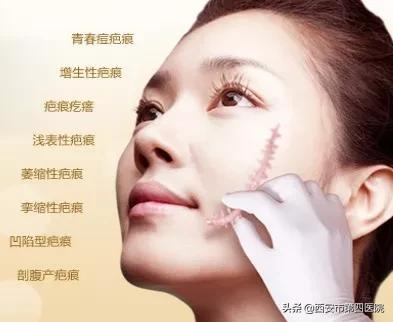 #安心變美課堂##我的安心變美推薦# 鐳射祛疤,這些事項你瞭解嗎??? #安心變美課堂##我的安心變美推薦# 鐳射祛疤,這些事項你瞭解嗎???