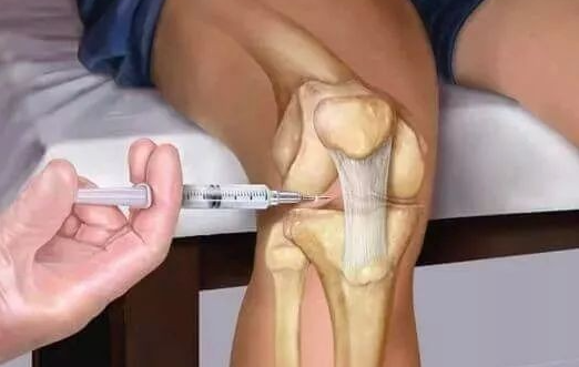 封閉針，究竟是“毒”還是“藥”？聽聽醫生怎麼說