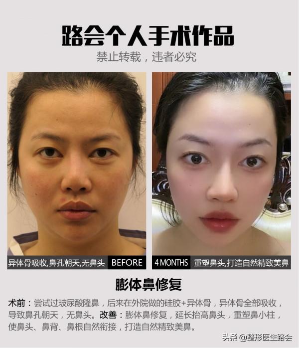 從事醫美整形工作30+年，談談我眼中的男女審美差異？