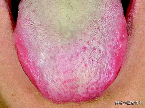 肝胃不和是怎麼回事？怎麼調理好？