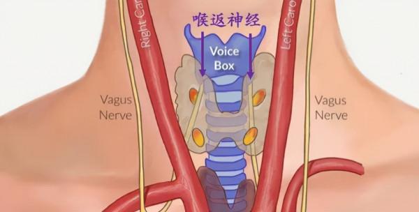 “小小”甲狀腺癌,竟引發慘劇 “小小”甲狀腺癌,竟引發慘劇