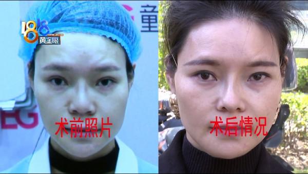 為了工作去手術,現在卻要換工作 為了工作去手術,現在卻要換工作