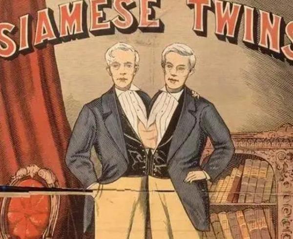 連體人赴美生22名孩子，迎娶姐妹花，走向人生巔峰