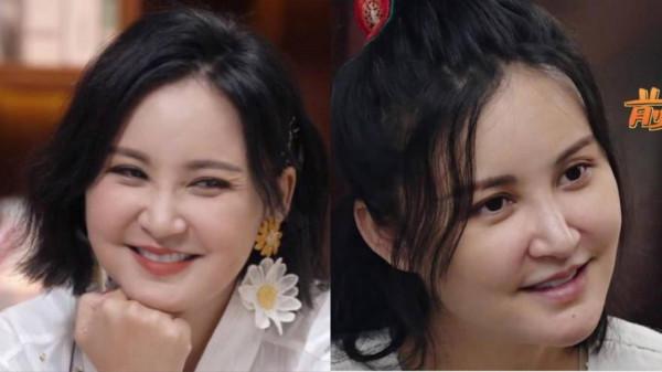 凹凸不平、眼睛擠成一條縫,“發麵饅頭”臉毀了多少高顏值明星? 凹凸不平、眼睛擠成一條縫,“發麵饅頭”臉毀了多少高顏值明星?