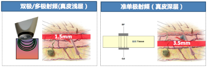 面部面板鬆弛下垂…很顯老怎麼辦？試試這個辦法