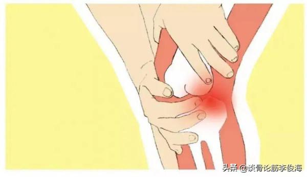 “關節積水”和“滑膜炎”是一回事?別再被混淆視聽了 “關節積水”和“滑膜炎”是一回事?別再被混淆視聽了