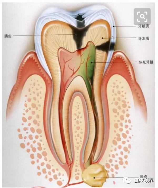 孩子拍牙片會損傷智商?真相是? 孩子拍牙片會損傷智商?真相是?