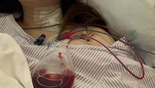 脖子成“天氣預報員”,18歲少女感冒查出甲癌 脖子成“天氣預報員”,18歲少女感冒查出甲癌