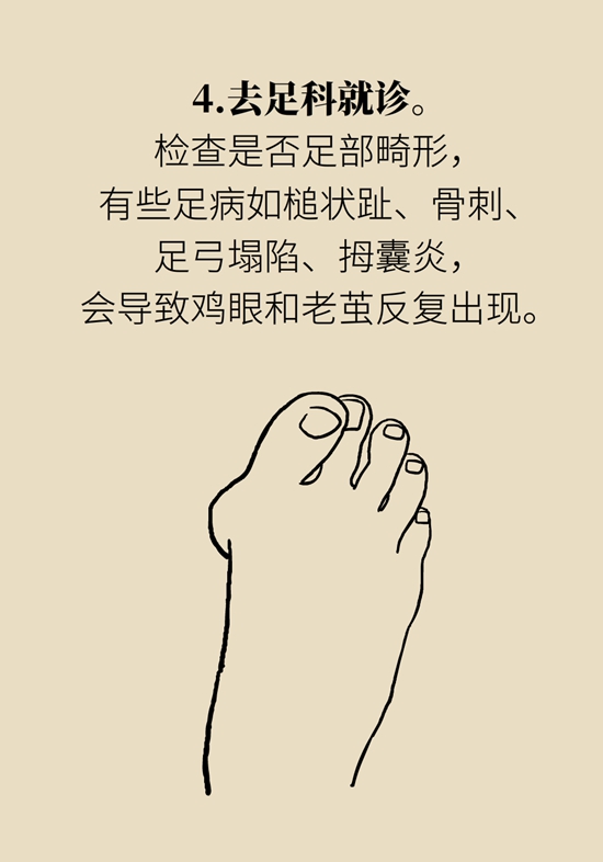 長了雞眼和老繭怎麼辦？這份防治指南請收好