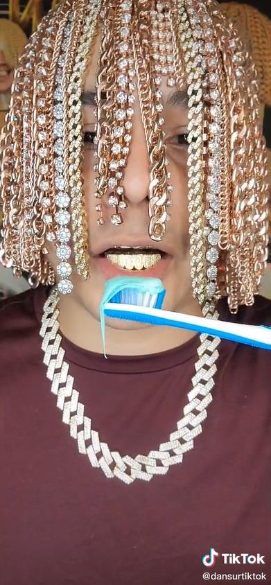 墨西哥Rapper頭皮植入數十條大金鍊，搞了一頭名副其實的金髮