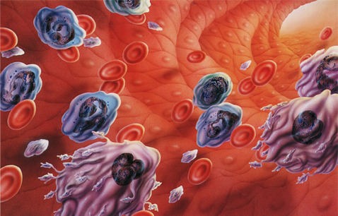 癌症痛苦程度排行榜，排名前十的都有哪些？