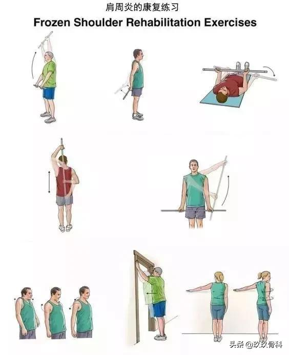 10套頸、肩、背、腰、腿的疼痛康復練習序列
