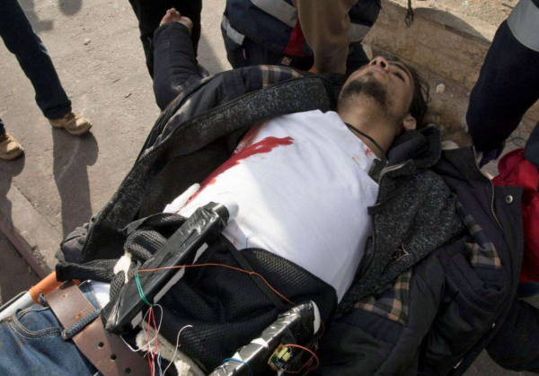 假如人被槍打了,會有什麼樣的感覺?是直接去世還是疼痛難忍? 假如人被槍打了,會有什麼樣的感覺?是直接去世還是疼痛難忍?