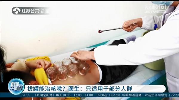 拔罐能治咳嗽？醫生：祛寒祛溼，只適用於部分人群