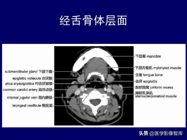 CT斷層解剖圖譜最全總結「推薦收藏」 CT斷層解剖圖譜最全總結「推薦收藏」