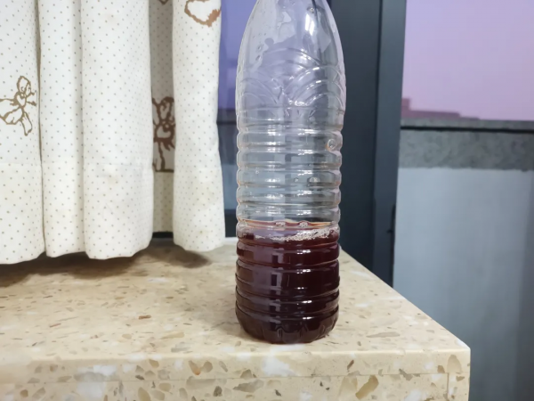 黃色尿液變黑了?細心的爸爸發現孩子尿液偷偷變色,查出罕見病 黃色尿液變黑了?細心的爸爸發現孩子尿液偷偷變色,查出罕見病