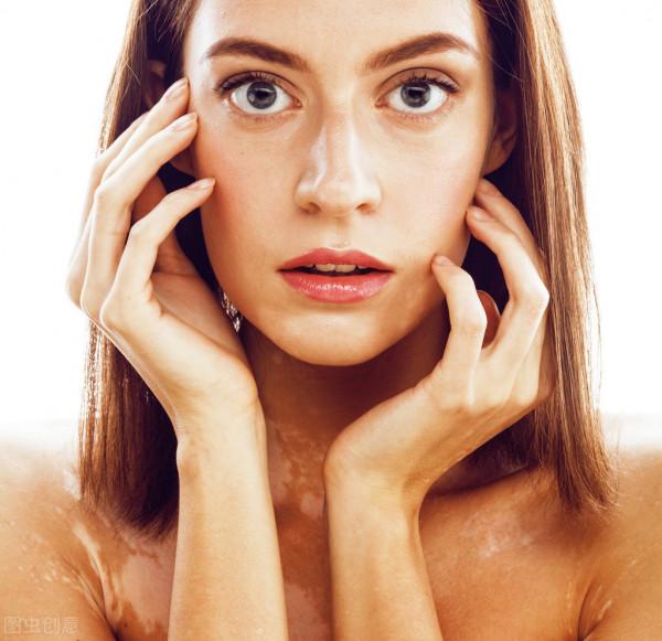 如何有效防止白癜風擴大 如何有效防止白癜風擴大