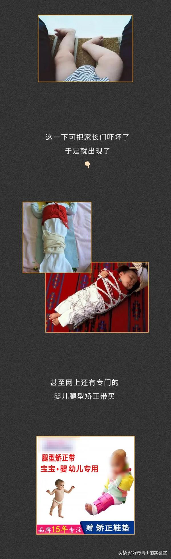 孩子的頭都畸形了，他的父母卻還在炫耀