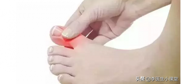 怎樣正確服用維生素B2、B12、C和葉酸？餐前服用好還是餐後服用好