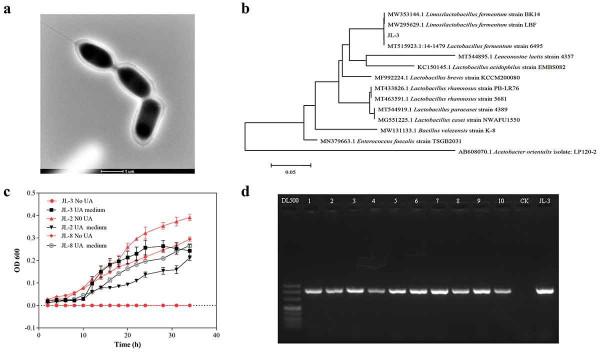 每10人中就有1位患者！蘭州大學直擊高尿酸，一招讓酸奶變身“排酸利器”