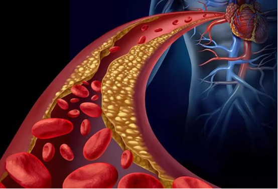 血脂高的人需注意，這種粗糧儘量少吃，或會對身體不利