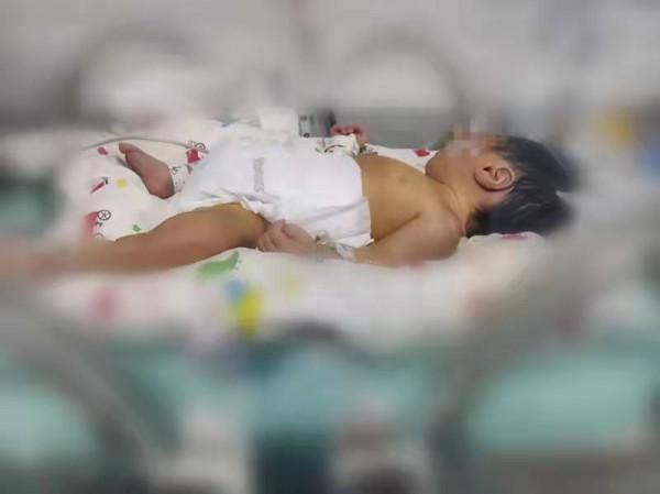 省婦幼保健院兒外科為腸部畸形患兒實施微創腹腔鏡手術 省婦幼保健院兒外科為腸部畸形患兒實施微創腹腔鏡手術
