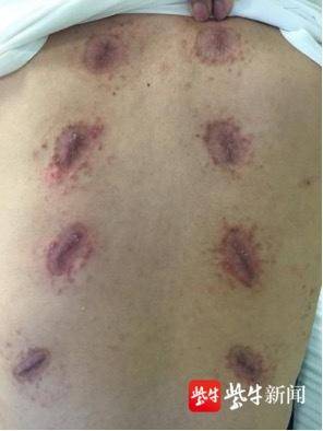 世界關節炎日丨偏方治療類風溼關節炎?當心留下難言的“痛” 世界關節炎日丨偏方治療類風溼關節炎?當心留下難言的“痛”