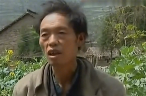 1961年，中科院專家去貴州調查&OpenCurlyDoubleQuote;鬼剃頭&rdquo;，結果自己也一夜變光頭