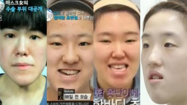 宋智雅當選韓國top長相,但其實是下等臉? 宋智雅當選韓國top長相,但其實是下等臉?