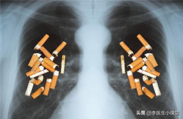 長期吸菸的人突然戒掉,身體會受什麼影響嗎?聽聽醫生怎麼說 長期吸菸的人突然戒掉,身體會受什麼影響嗎?聽聽醫生怎麼說