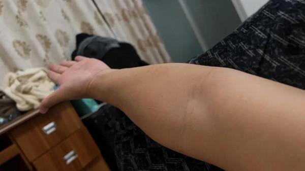 艾灸調理身體效果看的見