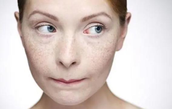 湖南一女子堅持吃“黑米”淡斑，三個月後，有什麼變化呢？