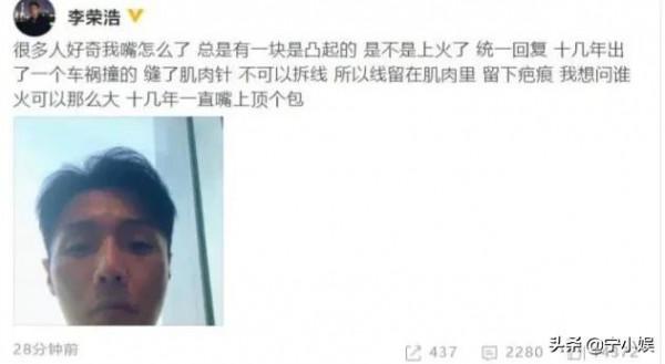 又一女星出車禍,國慶出行安全第一,這6位明星個個都是死裡逃生 又一女星出車禍,國慶出行安全第一,這6位明星個個都是死裡逃生