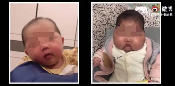 5月大嬰兒變“大頭寶寶”！家裡有這種兒童面霜的，請立即停用