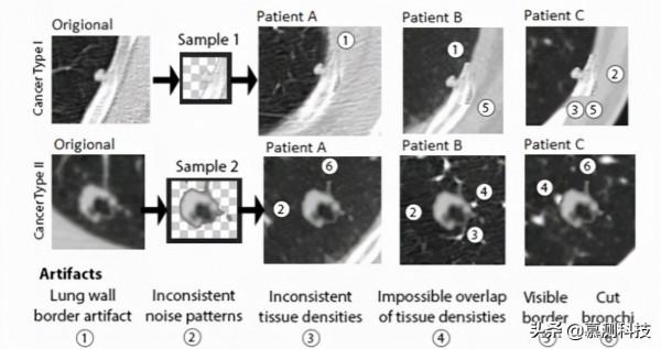 CT-GAN：利用深度學習惡意篡改三維醫學影象