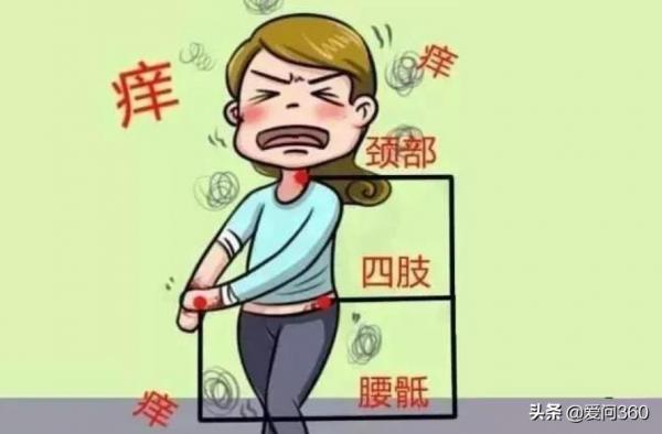 溼疹癢得難受,小妙招幫你解憂,告別反覆發作的溼疹 溼疹癢得難受,小妙招幫你解憂,告別反覆發作的溼疹