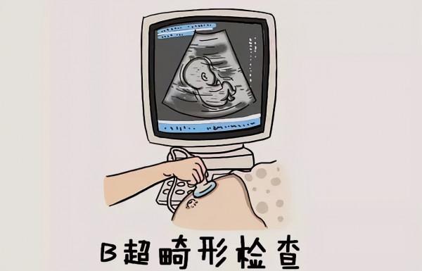 孕媽做四維為什麼不能讓家屬陪同？