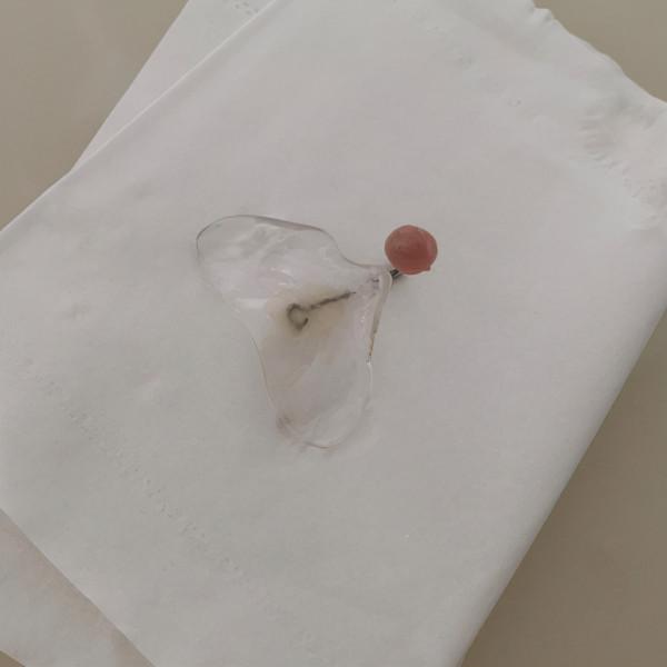 寶寶是一隻“小兔子”，還沒長牙就要開始正畸了