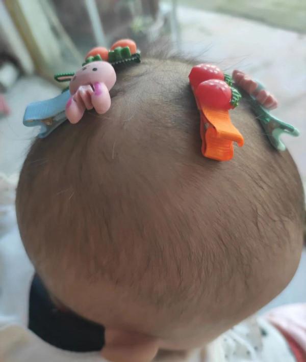 寶寶不吃飯日漸消瘦可能是疳積，歐陽醫生教你辨別孩子是否有疳積