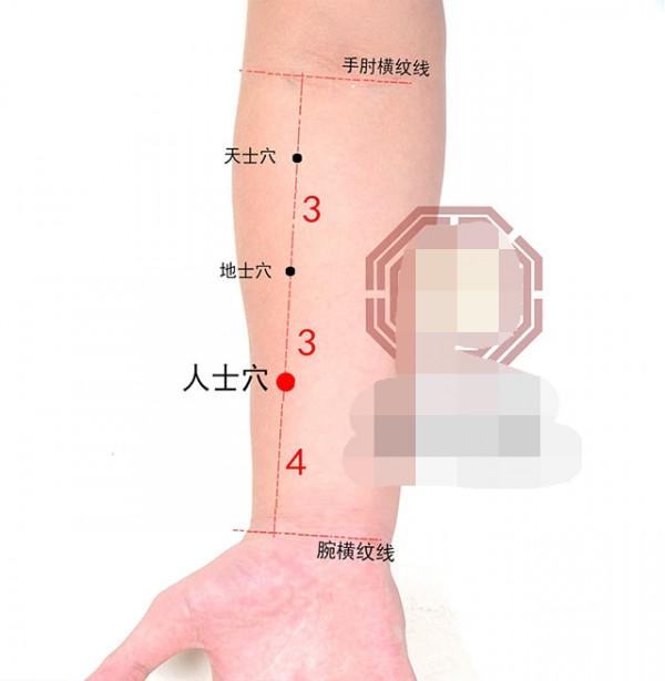 中醫針灸感冒、上呼吸道感染疾病處方2