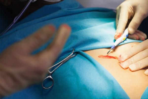 為什麼用布蒙著患者，透過一個洞去手術，很多人只知其一不知其二