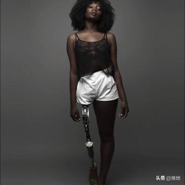 6歲被截肢，20歲被網暴，女孩兒鼓足勇氣成為內衣模特